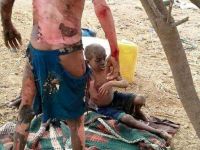 الإعتداء السعودي على اليمن ..